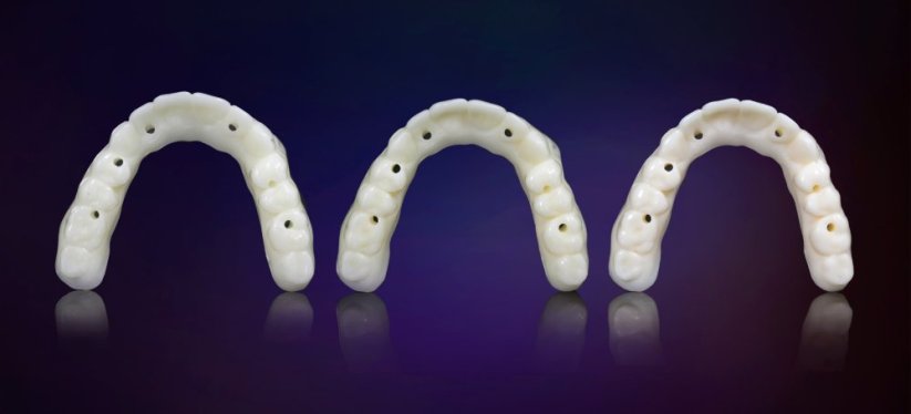 KeyPrint KeyDenture Try-In - živica na skúšobné protézy