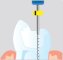 Endodontické nástroje