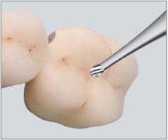 Edenta Lab C1 - TC nástroje, Contouring Fissure Bur - 5 ks