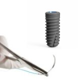 Chirurgia a implantológia
