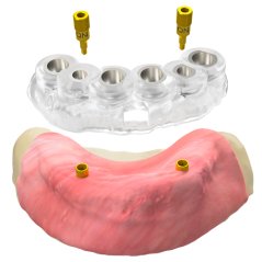 Komponenty pre bezzubé a čiastočne ozubené čeľuste LASAK