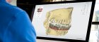 Digitálna implantológia