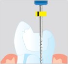 Endodontické nástroje