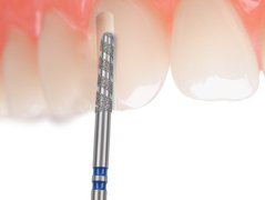 Edenta KT856/KT881 - diamantové nástroje, crown separator - 5 ks