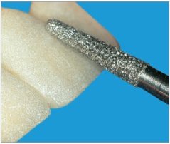 Edenta Lab 850 - Round End Taper, diamantové nástroje - 3 ks